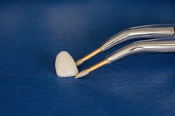 The Versatile Uses Of Dental Crowns