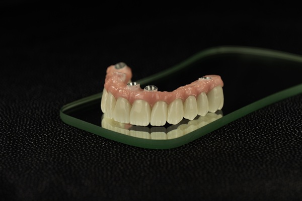 Implant Supported Dentures Guide: Process, Benefits, And Care