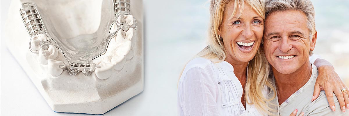 Boca Raton Implant Supported Dentures