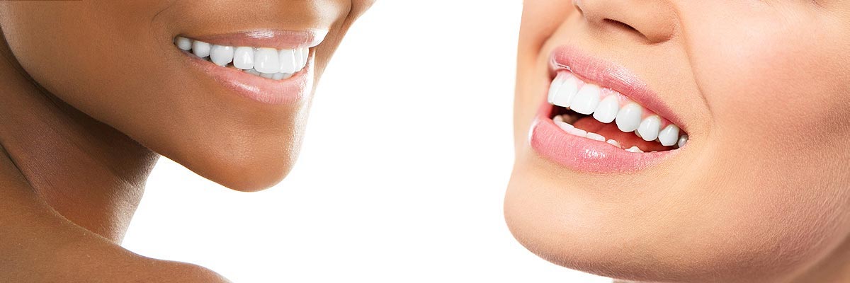 Boca Raton Teeth Whitening