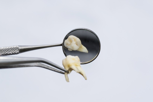Tooth Extraction Guide: What Happens During And After The Procedure