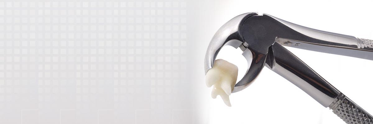 Boca Raton Tooth Extraction